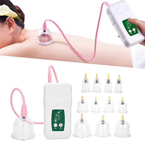 Vacuum Cupping Cup, USB Charging Intelligent Operation Anti Cellulite Body Massage Helper, Electric Suction Cupping Set for Salon or Home Use