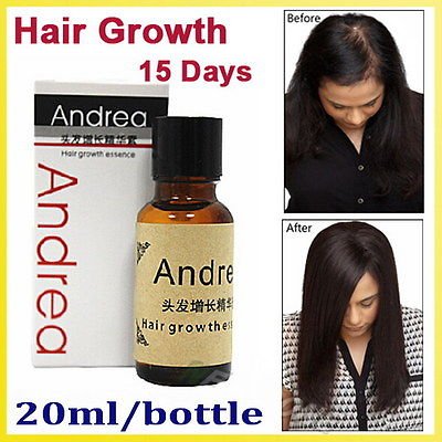Fast Hair Growth Solution Essence Liquid for all hair loss type 20ml regrowth By U Happy