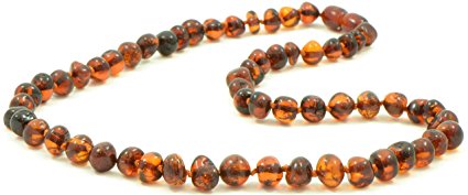 Baltic Amber Necklaces for Adults - 21.6 inches(55cm) - Dark Cognac Color - Authentic / Polished Baltic Amber Beads {0007}